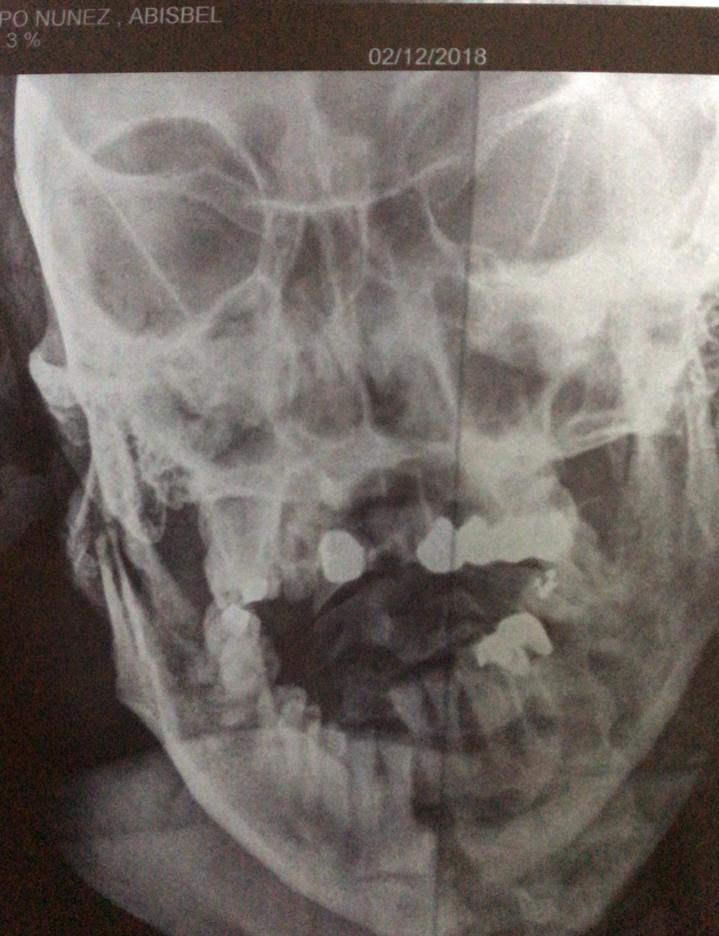 WhatsApp Image 2018-12-03 at 18.54.06